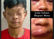 Korban Dihajar Hingga Bengkak di Bagian Mulut dan Lebam Di Mata