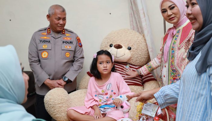 Sentuhan Kemanusiaan Kapolda Kalsel, Dua Bocah Yatim Piatu Bangkit Pasca Operasi